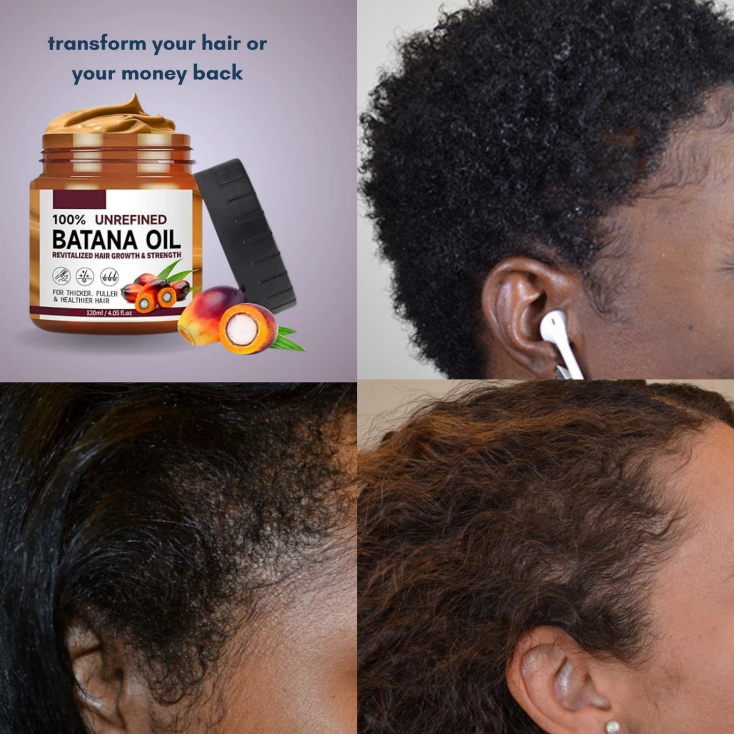 Huile naturelle de croissance des cheveux Batana (Togo)