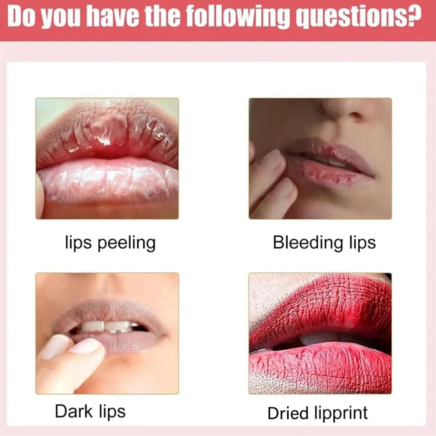 Baume à lèvres foncé éclaircissant (Mali)