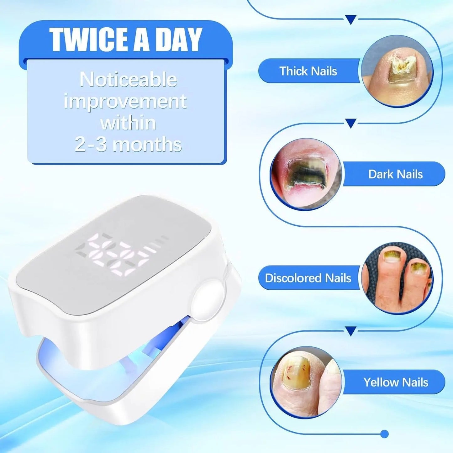 Laser pour mycoses des ongles (Burkina faso)