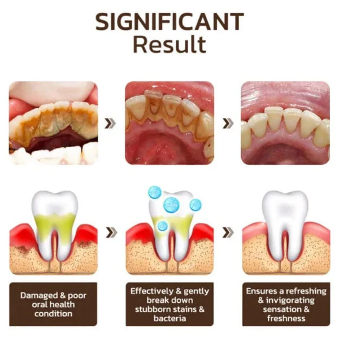 Dentifrice blanchissant intensif dentaire probiotique SP-4 (Togo)