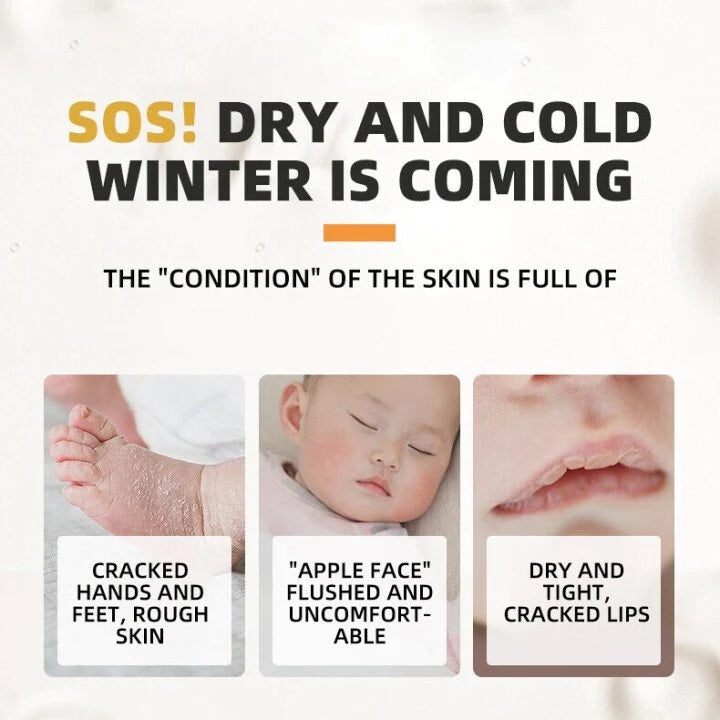 Crème anti-fissures pour pieds crevassés (Niger)