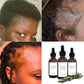 Huile de croissance capillaire naturelle (Togo)
