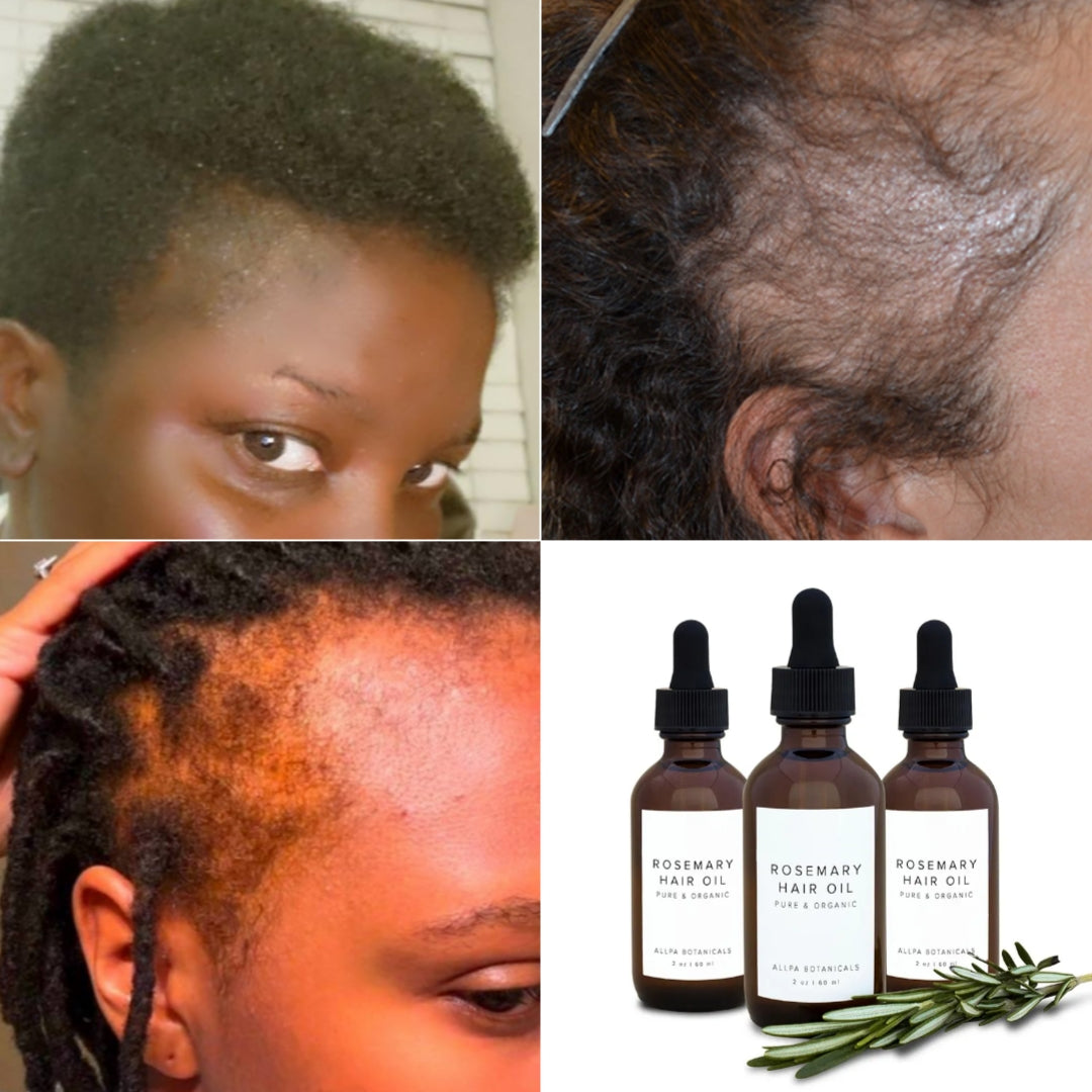 Huile de croissance capillaire naturelle (Togo)