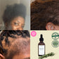 Huile de croissance capillaire naturelle (Togo)