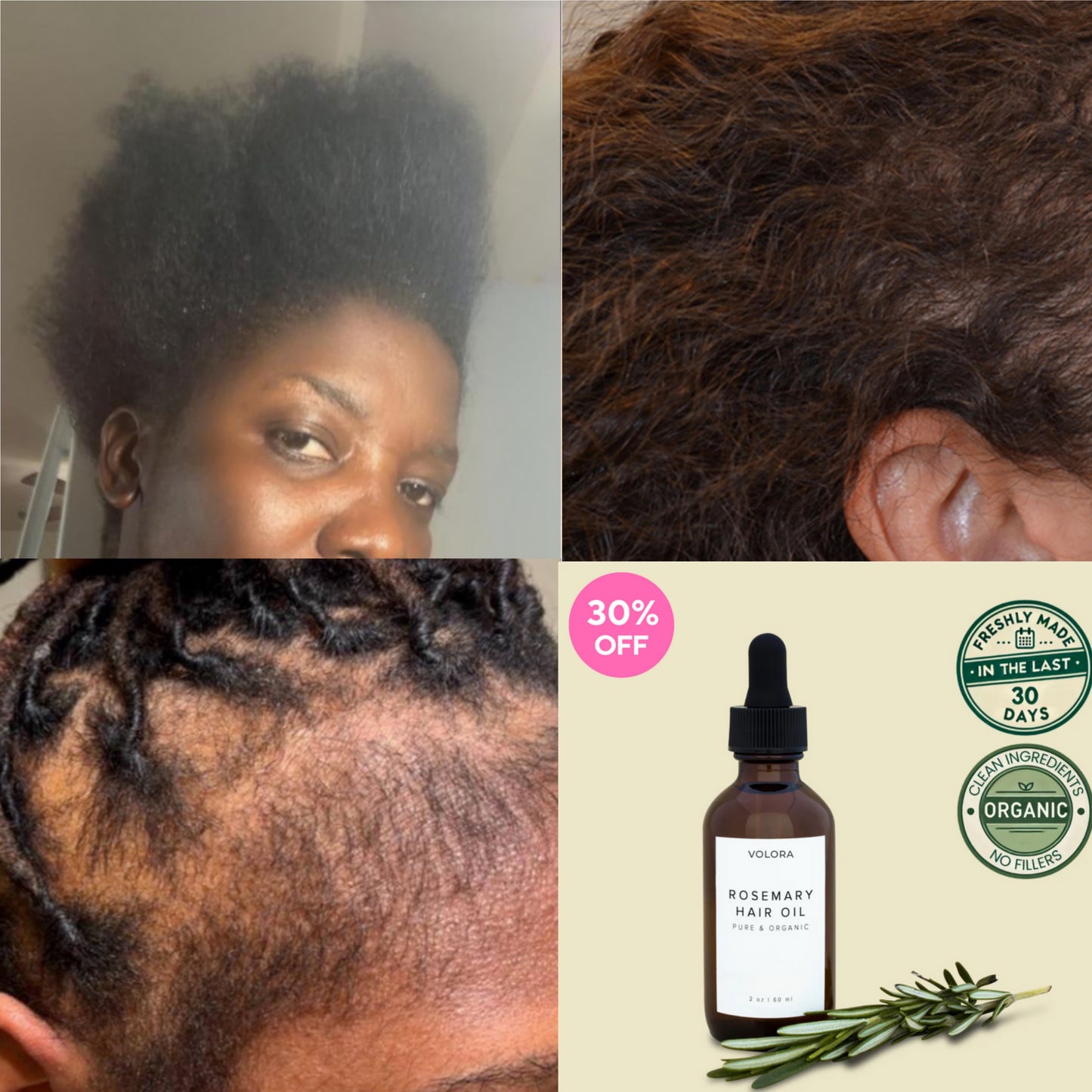 Huile de croissance capillaire naturelle (Togo)