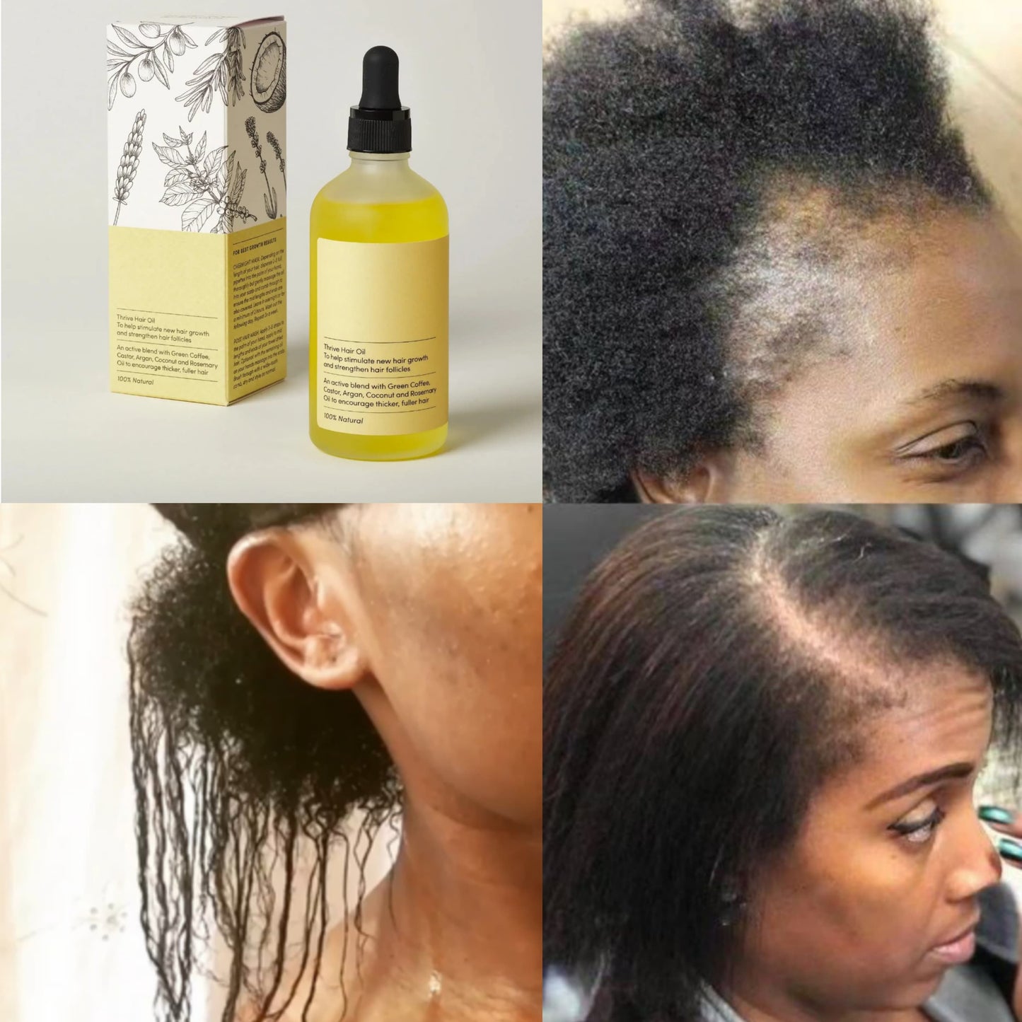 Huile de croissance naturelle des cheveux (Sénégal)