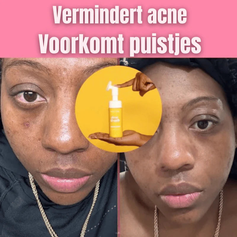 Nettoyant éclat VIRAL au curcuma (Cameroun)