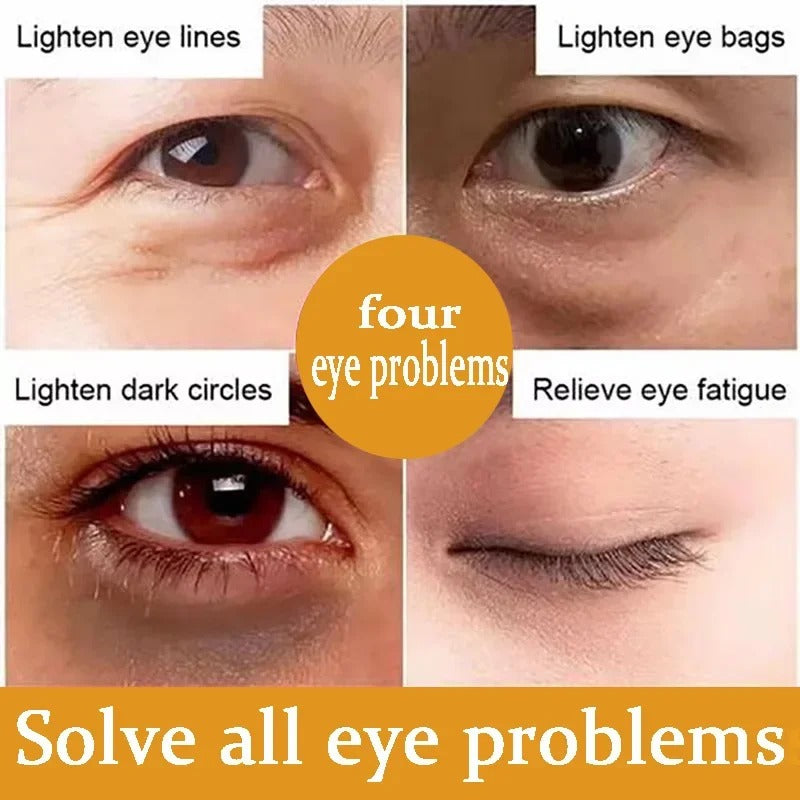 Huile essentielle pour les yeux (Togo)