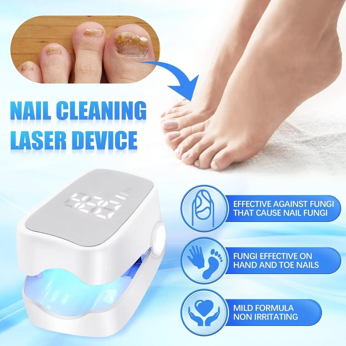 Laser pour mycoses des ongles (Chad)